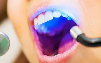 Laser_Dentistry_1
